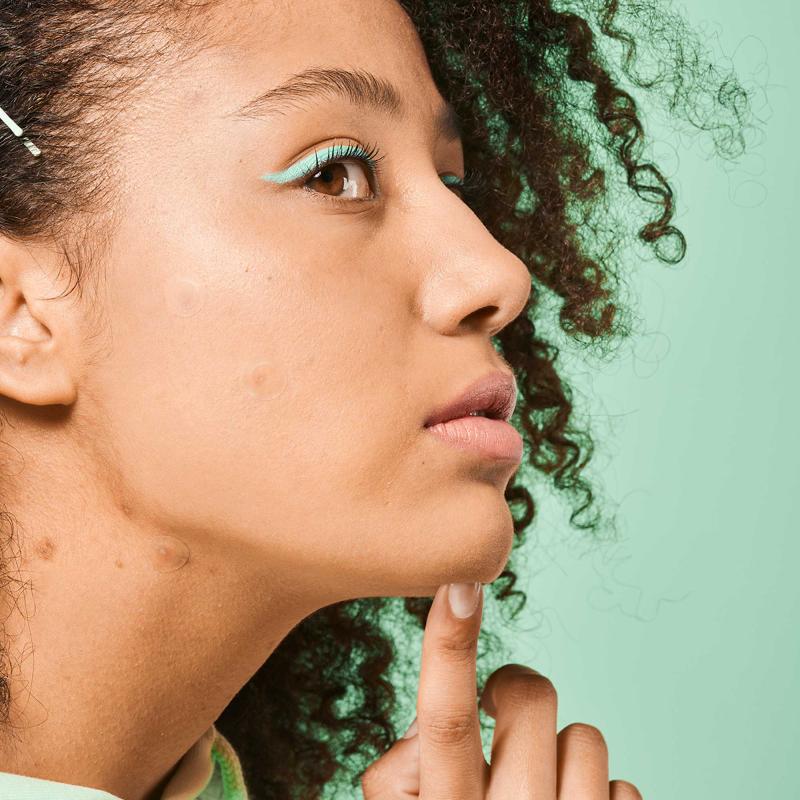 Parches SOS Granos Ácido Salicílico, Árbol de Té y Centella Asiática Iroha Nature