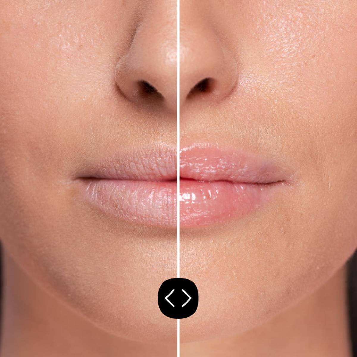 Pack 2x Voluminizador Labial Hialurónico Freshly 5ml